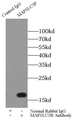 Immunoprecipitation