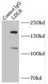 Immunoprecipitation