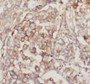 Immunohistochemistry