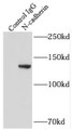 Immunoprecipitation