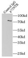 Immunoprecipitation