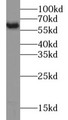 Western Blot