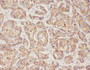 Immunohistochemistry