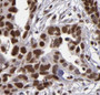 Immunohistochemistry