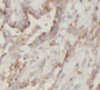 Immunohistochemistry