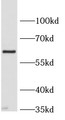 Western Blot