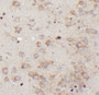 Immunohistochemistry