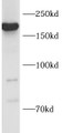 Western Blot