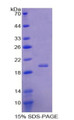 Figure 1. SDS-PAGE