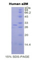 Figure 1. SDS-PAGE