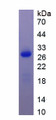 Figure 1. SDS-PAGE