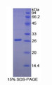 Figure 1. SDS-PAGE