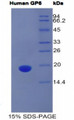 Figure 1. SDS-PAGE