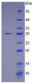 Figure 3. SDS-PAGE