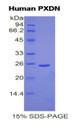 Figure 1. SDS-PAGE