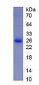 Figure 1. SDS-PAGE