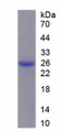 Figure 1. SDS-PAGE