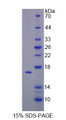 Recombinant Mouse Tumor Necrosis Factor Beta (TNFb), Cat#RPU44229