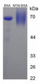 BSA Conjugated Human Cross Linked N-Telopeptide Of Type I Collagen (NTXI), Cat#RPU50155