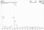 OVA Conjugated Rat Beta-Crosslaps (bCTx), Cat#RPU50944