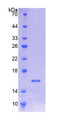 Figure 1. SDS-PAGE