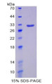 Figure 1. SDS-PAGE