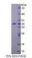 Figure 1. SDS-PAGE