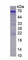 Rat Osteopontin (OPN), Active Protein, Cat#RPU54842