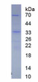 Figure . SDS-PAGE