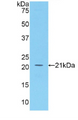 Figure . Western Blot