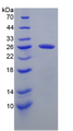 Figure . SDS-PAGE