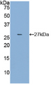 Figure . Western Blot