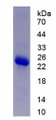 Figure . SDS-PAGE