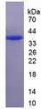 Figure. SDS-PAGE