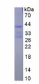 Figure . SDS-PAGE