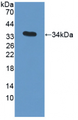 Figure. Western Blot