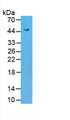 Figure. Western Blot