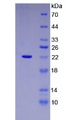 Figure . SDS-PAGE