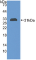 Figure . Western Blot