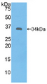 Figure . Western Blot