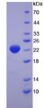 Figure . SDS-PAGE