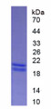 Figure . SDS-PAGE