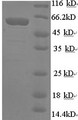 (Tris-Glycine gel) Discontinuous SDS-PAGE (reduced) with 5% enrichment gel and 15% separation gel.