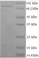 (Tris-Glycine gel) Discontinuous SDS-PAGE (reduced) with 5% enrichment gel and 15% separation gel.