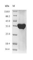 (Tris-Glycine gel) Discontinuous SDS-PAGE (reduced) with 5% enrichment gel and 15% separation gel.