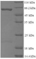 (Tris-Glycine gel) Discontinuous SDS-PAGE (reduced) with 5% enrichment gel and 15% separation gel.