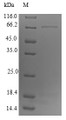 (Tris-Glycine gel) Discontinuous SDS-PAGE (reduced) with 5% enrichment gel and 15% separation gel.