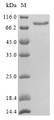 (Tris-Glycine gel) Discontinuous SDS-PAGE (reduced) with 5% enrichment gel and 15% separation gel.