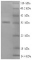 (Tris-Glycine gel) Discontinuous SDS-PAGE (reduced) with 5% enrichment gel and 15% separation gel.