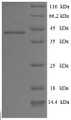 (Tris-Glycine gel) Discontinuous SDS-PAGE (reduced) with 5% enrichment gel and 15% separation gel.